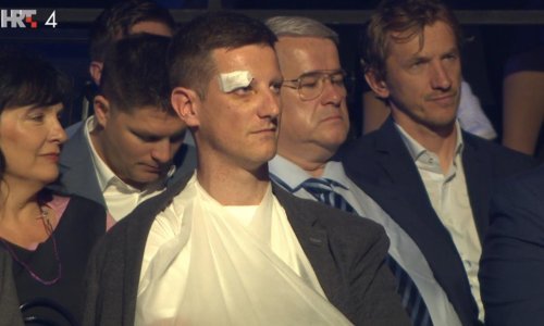 Mladi novinar HRT-a objasnio kako je 'zaradio' slomljenu ruku i modricu