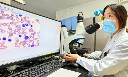 WHO: Umjetna inteligencija bolje odabire organe donora, ali pravi i ozbiljne pogreške