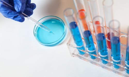 Alarm u Europi: Širi se zaraza opasnom bakterijom otpornom na antibiotike