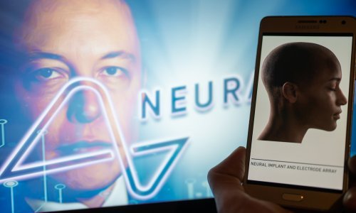 Musk dobio zeleno svjetlo: Moždane implantate može ispitivati na ljudima