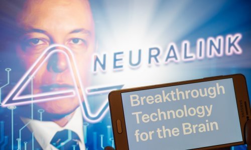 Musk može testirati moždane implantate na ljudima, ali čeka ga još puno posla