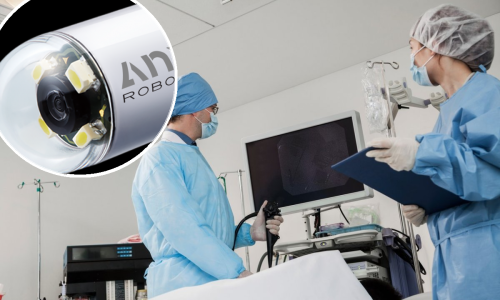 Zbogom gastroskopiji: Izmišljena kapsula koju pacijent proguta, a liječnik navodi