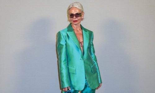 Sjedokosa modna zvijezda blista u ljetnoj haljini koja slavi figuru i podiže raspoloženje