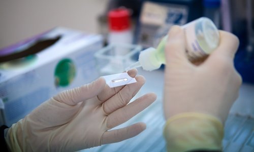 Cjepiva protiv raka su stigla, no preskupa su. Glavnu riječ i dalje imaju - investitori