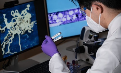 Alarmantan povratak jedne od najstarijih spolnih bolesti: Sve više se prenosi na djecu