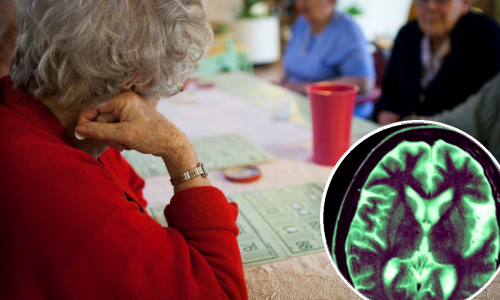 Donanemab je prekretnica u borbi protiv Alzheimerove bolesti. No postoje i rizici