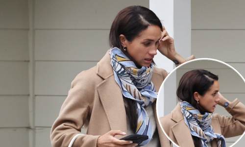 Što se krije iza neobičnih flastera koje na zapešću nosi Meghan Markle?