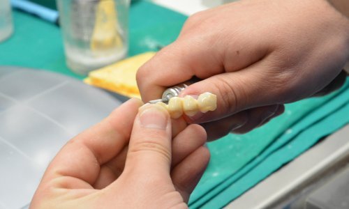 Zadar kreće s programom posebne dentalne skrbi, evo o čemu je riječ