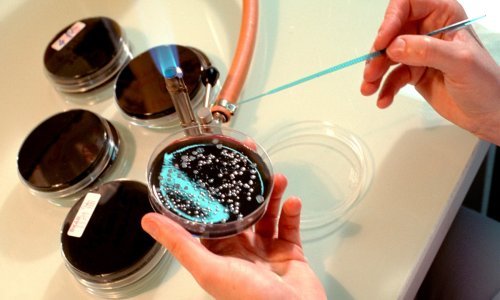 U Poljskoj 19 mrtvih u izbijanju legioneloze: Evo o kakvoj je bolesti riječ