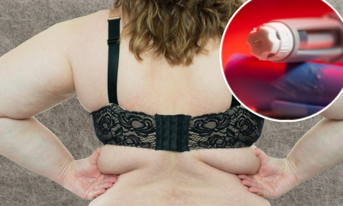 Opasno po život: Europljani masovno posežu za lažnim lijekovima za mršavljenje