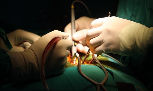 U zagrebačku bolnicu stigao najsuvremeniji robot za operaciju kralježnice, evo što može