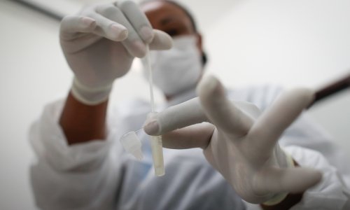 Nevjerojatno: Gotovo dvije godine svakog dana bio je pozitivan na covid!