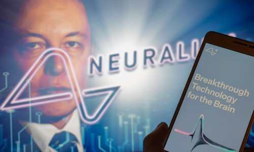 Muskov Neuralink dobio dopuštenje za ugradnju moždanih čipova u ljude s paralizom