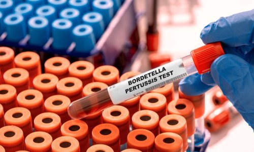 Od hripavca 40 oboljelih na splitskom području i 12 od Zagreba do Dubrovnika