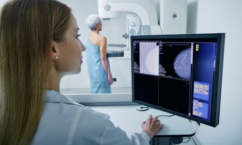 Žene umiru od raka jer nemaju optimalnu skrb, čak ni na Zapadu. Evo što bi ih moglo spasiti