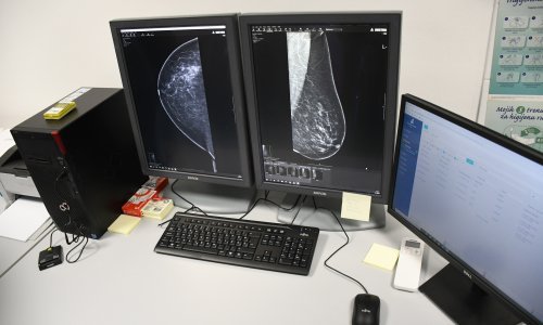 Uskoro mobilni mamograf u ruralnim dijelovima Splitsko-dalmatinske županije