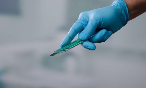 Ginekolog u KBC-u Split kolegi zaprijetio skalpelom