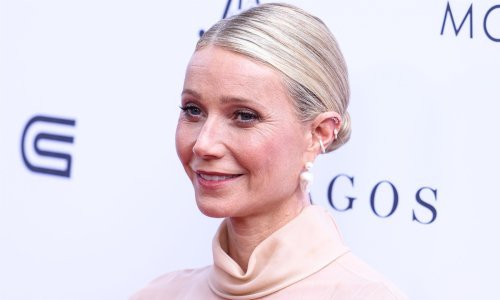 Gwyneth Paltrow otvoreno progovorila o svom iskustvu s botoksom