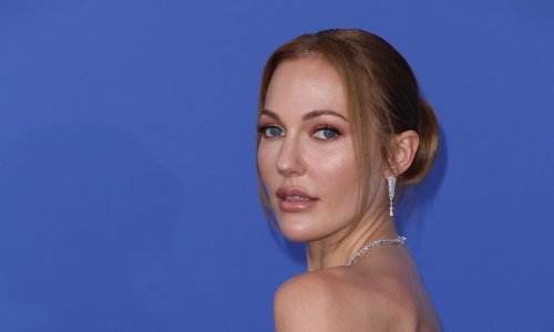 Slavna Turkinja na meti kritika zbog plastičnih i estetskih korekcija