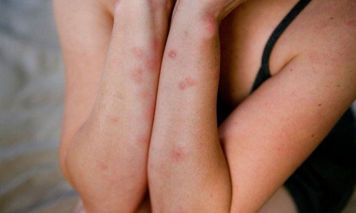 Pošast stjenica došla i u Hrvatsku, a evo gdje se pojavljuju i kako se šire