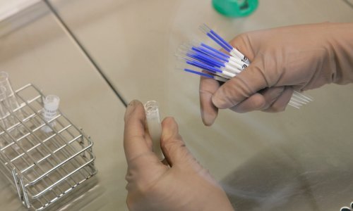 Hrvatska nema banku gameta pa parovi odlaze u inozemstvo