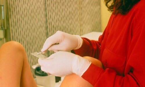 Znanstvenici: Najveći napredak u liječenju raka grlića maternice u 20 godina