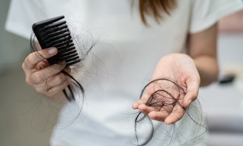 Muči li vas ispadanje kose? Predstavljamo vam inovativnu formulu i zaštitu od ispadanja!