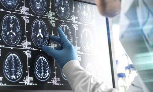 Revolucija u medicini: Znanstvenici napravili najveću mapu mozga ikad