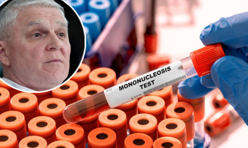 Sve je više slučajeva mononukleoze: Liječnik otkriva kako prepoznati simptome
