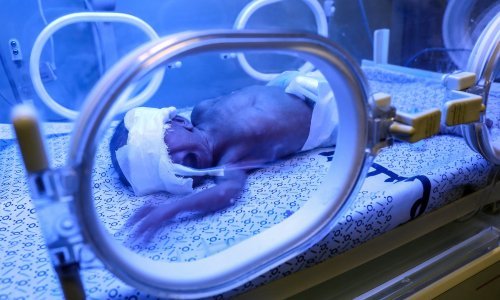 Iz bolnice Al Šifa evakuirano 31 nedonošče