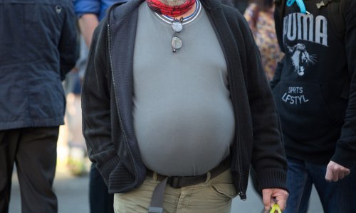 Akcijski plan protiv debljine, bolesti koja prijeti trećini građana Hrvatske