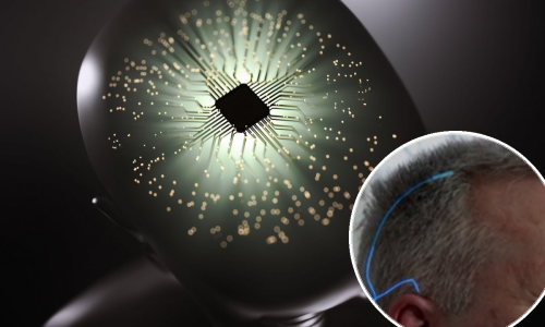 Ovo je Mark, boluje od ALS-a. Evo kako pomoću implatanta u mozgu upravlja računalom