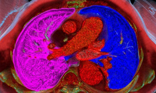 Promjene u liječenju ozbiljnih bolesti: Ljudsko tijelo dobilo je još jedan organ