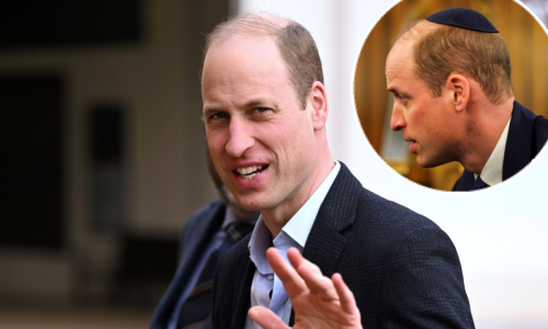 Što se događa? Kateina fotka je povučena, a pojavila se ona princa Williama s masnicom na vratu