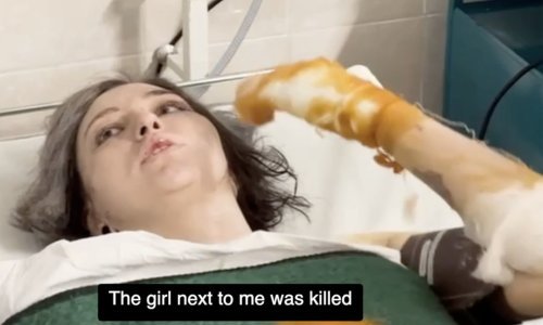 Dojava o bombi: Evakuirana bolnica u Moskvi sa žrtvama terorističkog napada