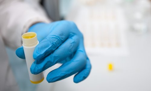 Sanitarna inspekcija češlja tržište, alarmantno stanje s kozmetikom