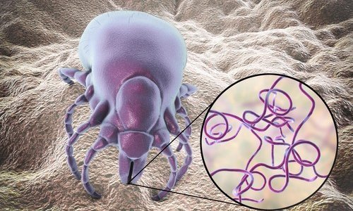 Lajmska bolest može biti strašna: Osip može izostati, ali pazite na ove simptome