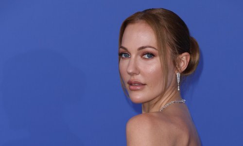 Slavna Turkinja nije jedina ljepotica u obitelji, ima sestru koja je također vrlo uspješna