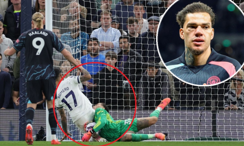 City će dvije najvažnije utakmice sezone igrati bez prvog golmana