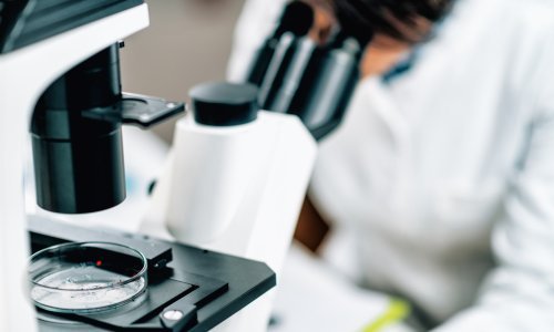 Mikroplastika je sada pronađena i u testisima: Stručnjaci otkrili kako se zaštititi