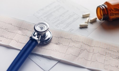 Umjetna inteligencija mogla bi pomoći pri ranom otkrivanju zatajenja srca