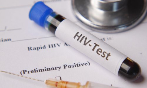 Hrvatska lani imala više od 2000 oboljelih od HIV/AIDS-a: Ovo su najčešće spolne bolesti