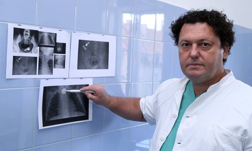 Preminuo poznati zagrebački kirurg: 'Malo je takvih kao Tony'