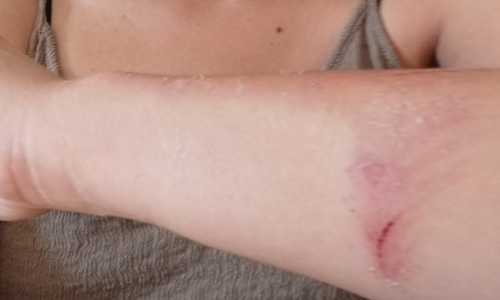 Napadnuta nagrađivana novinarka: Na nju nasrnuo otac i sestra poznatog HDZ-ovca