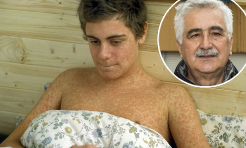 Morbile uzele prve žrtve u BiH. Hrvatski epidemiolog: 'Pod stalnom smo prijetnjom'