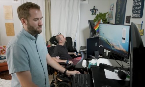 Ovaj uređaj je nova nada za pacijente s epilepsijom, tumorom na mozgu i Parkinsonom