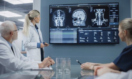 Znanstvenici stvorili sićušne nanorobote kojima će liječiti aneurizme mozga