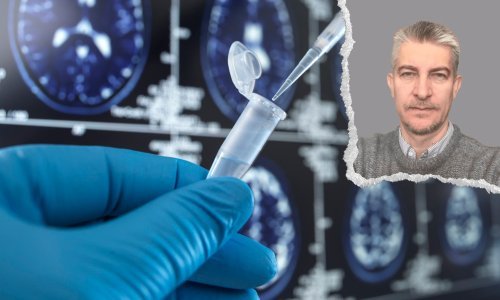 Hrvatski istraživač mozga: Svi smo već pomalo digitalno dementni i to će uskoro biti velik problem