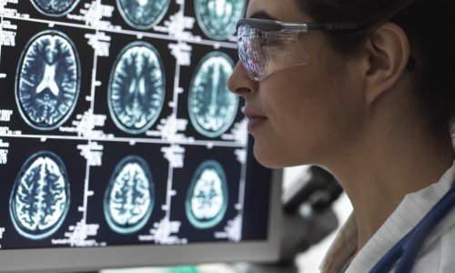 Mensa kreće s testiranjem inteligencije Hrvata: Znate li riješiti ovaj zadatak?