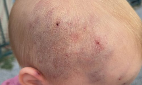 Majka u Slavonskom Brodu došla po bebu u jaslice, na glavi je imala podljeve i modrice